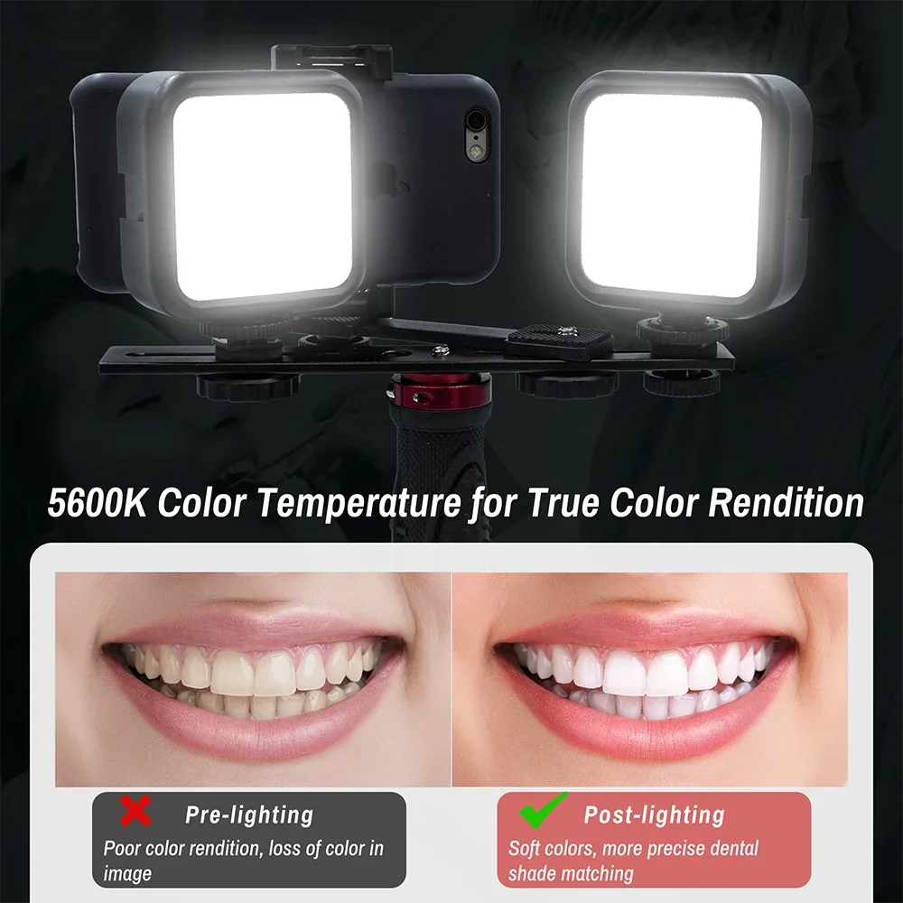 Twin Light For Mobile Dental Photography